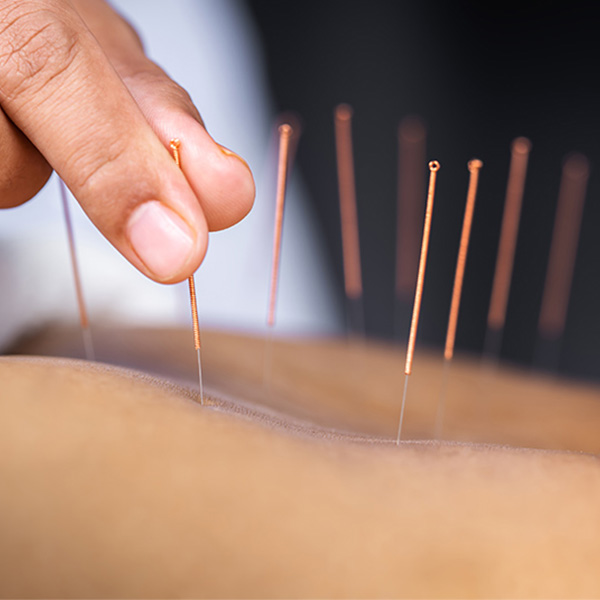 Manthra Health & Wellness Clinic+Acupuncture